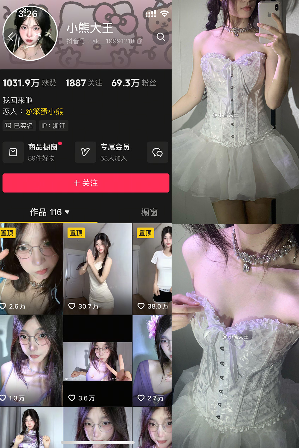 抖音 小熊大王 微密圈 001期 【32P】-温柔乡.cn